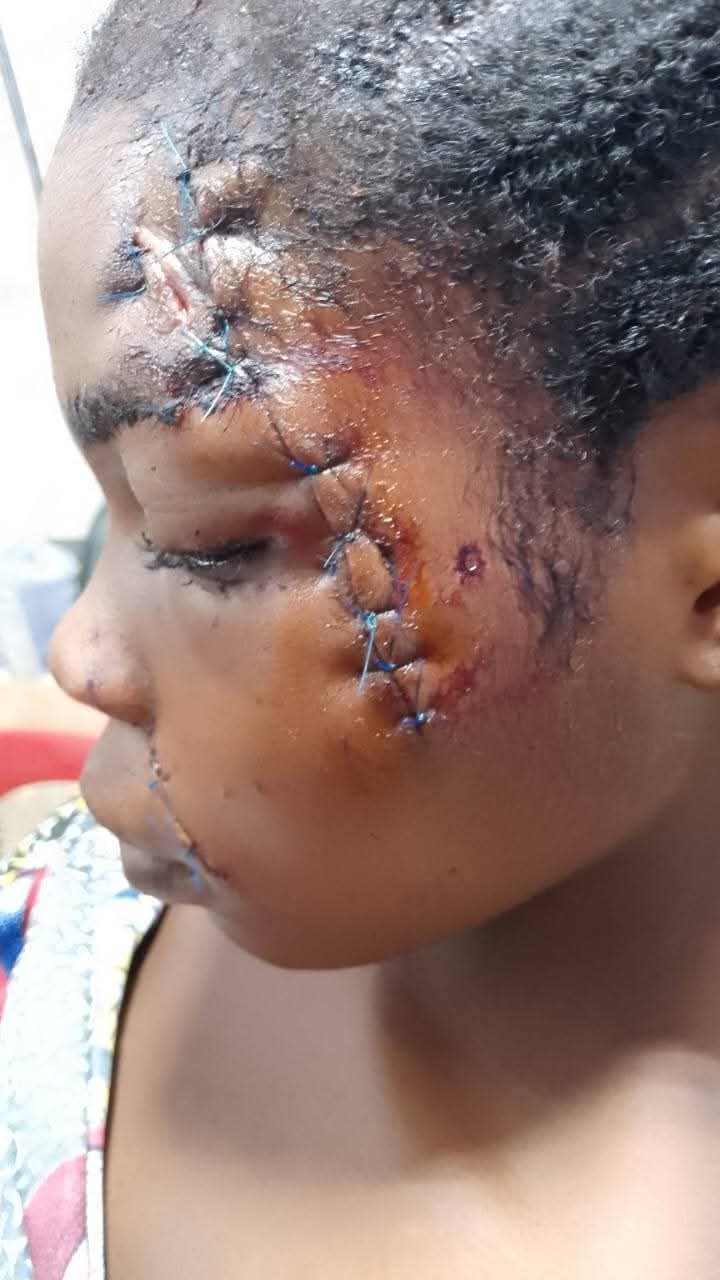 No fewer than seven persons, including a police officer, have been k!lled in some communities in Barkin Ladi Local Government Area of Plateau State.